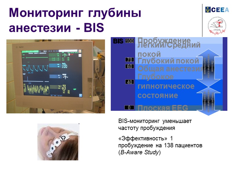 Мониторинг глубины анестезии - BIS BIS-мониторинг уменьшает частоту пробуждения «Эффективность» 1 пробуждение на 138